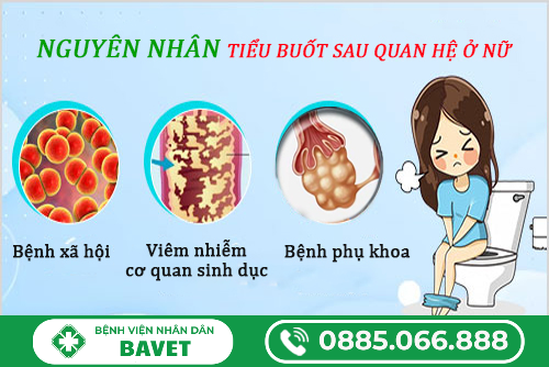 ĐI TIỂU BỊ BUỐT SAU KHI QUAN HỆ Ở NỮ