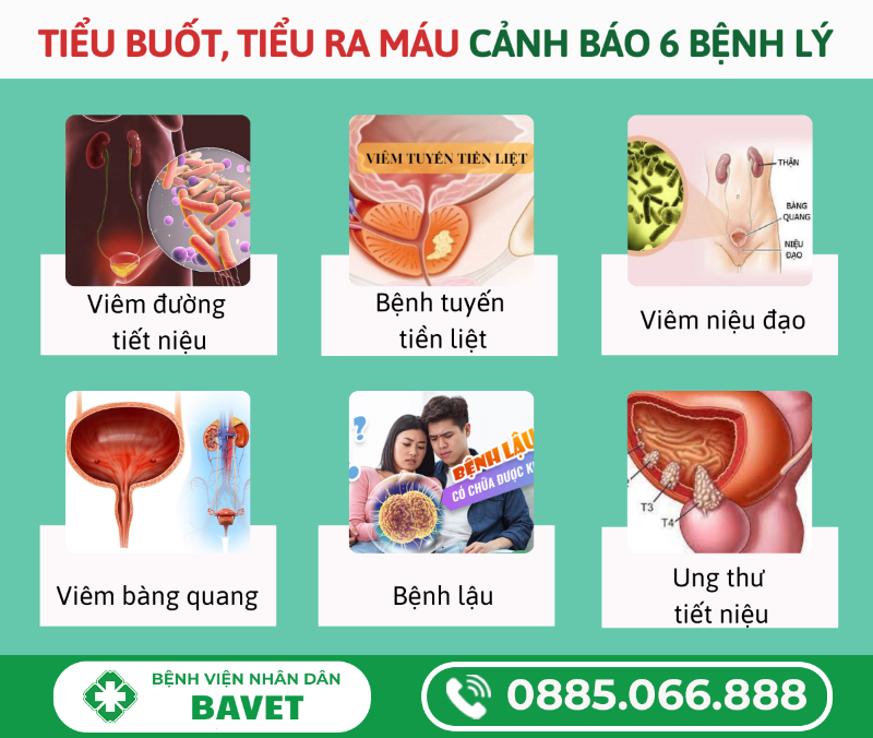 TIỂU BUỐT RA MÁU Ở NỮ GIỚI