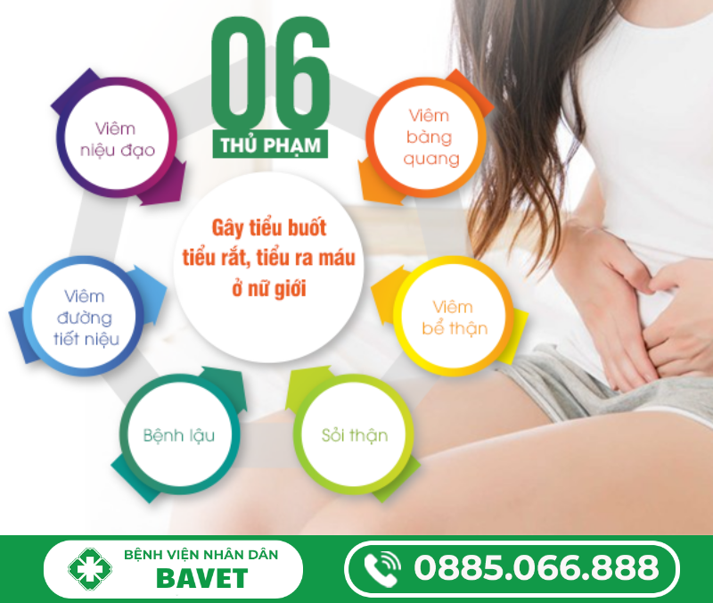 NGUYÊN NHÂN BỊ TIỂU BUỐT Ở NỮ