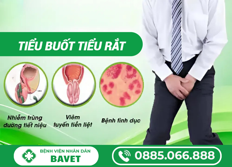 TIỂU RẮT VÀ BUỐT: NGUYÊN NHÂN, DẤU HIỆU VÀ BIẾN CHỨNG CẦN BIẾT
