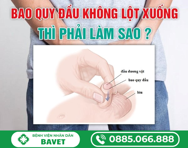 BAO QUY ĐẦU KHÔNG LỘT XUỐNG ĐƯỢC: NGUYÊN NHÂN VÀ CÁCH XỬ LÝ