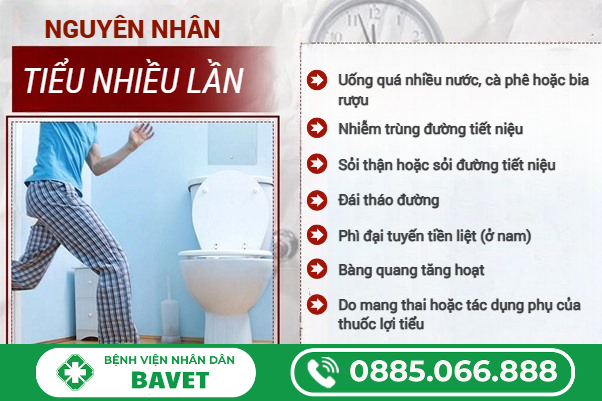 NGUYÊN NHÂN ĐI TIỂU NHIỀU LẦN