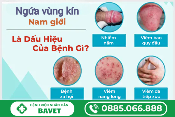 NGUYÊN NHÂN GÂY NGỨA VÙNG KÍN Ở NAM