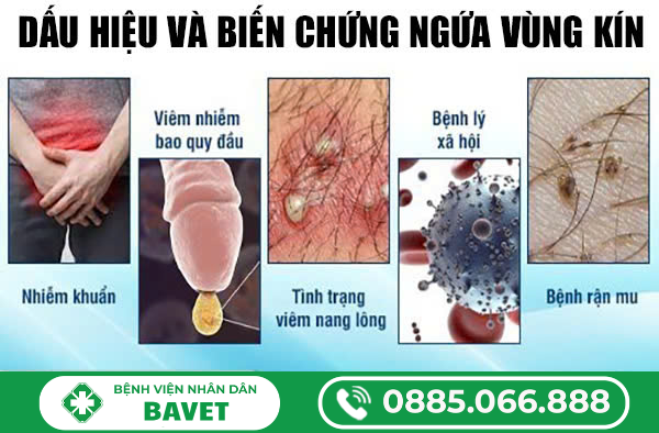 BỊ NGỨA Ở MU VÙNG KÍN NAM LÀ DO ĐÂU?
