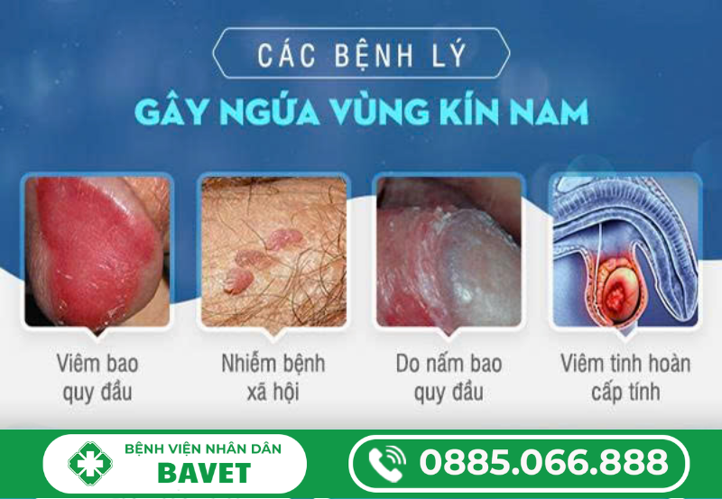 NGUYÊN NHÂN BỊ NGỨA DƯƠNG VẬT