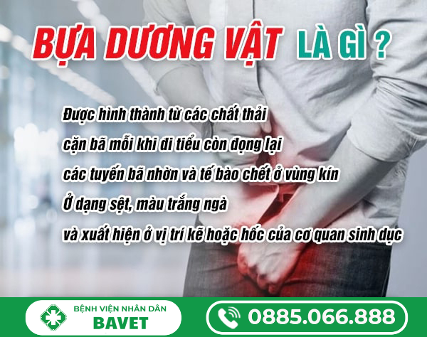 BỰA DƯƠNG VẬT LÀ GÌ? NGUYÊN NHÂN, DẤU HIỆU VÀ CÁCH XỬ LÝ