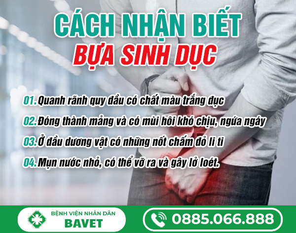 TÌM HIỂU BỰA SINH DỤC LÀ GÌ?