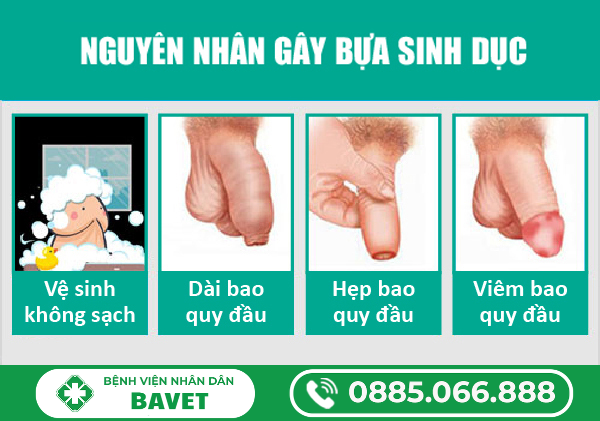 NGUYÊN NHÂN CÓ BỰA SINH DỤC Ở NAM GIỚI