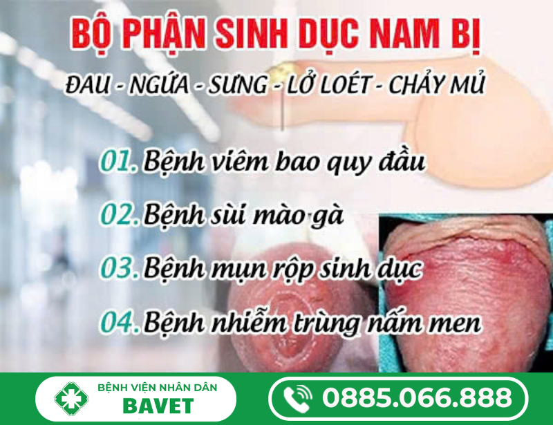 BỘ PHẬN SINH DỤC NAM BỊ ĐAU, NGỨA, SƯNG, LỞ LOÉT, CHẢY MỦ, NÓNG RÁT