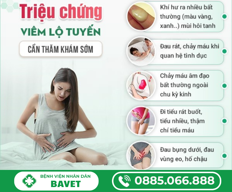 BIỂU HIỆN CỦA BỆNH VIÊM LỘ TUYẾN CỔ TỬ CUNG