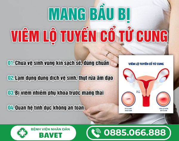 MANG BẦU BỊ VIÊM LỘ TUYẾN CỔ TỬ CUNG CÓ SAO KHÔNG?