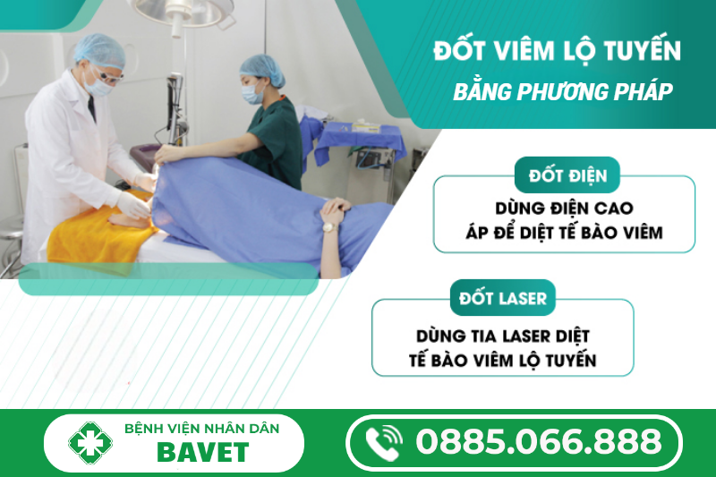 CÁC PHƯƠNG PHÁP ĐỐT VIÊM LỘ TUYẾN CỔ TỬ CUNG