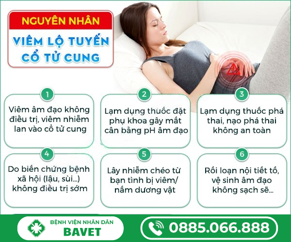 NGUYÊN NHÂN BỊ VIÊM LỘ TUYẾN CỔ TỬ CUNG