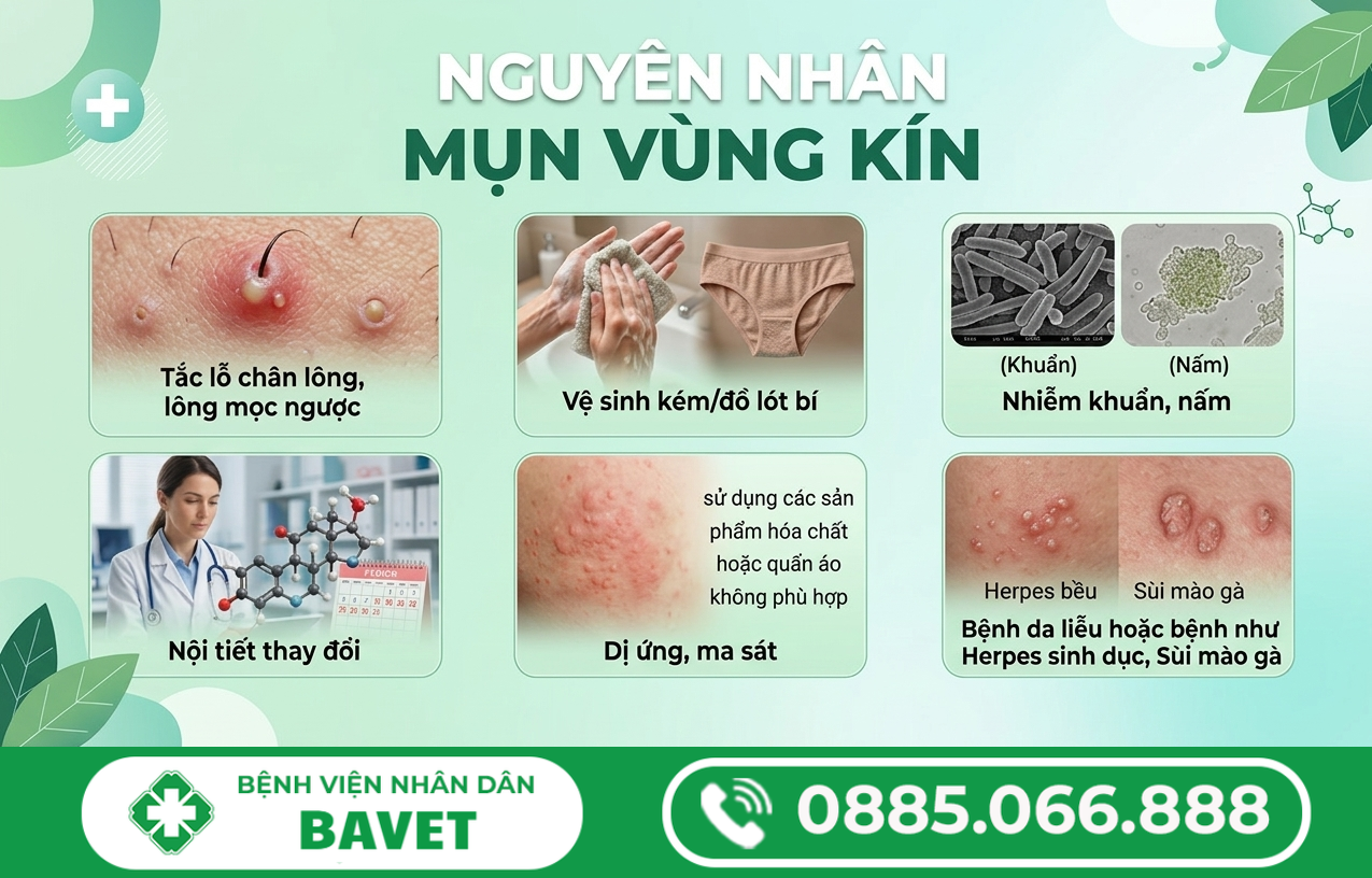 MỌC MỤN ĐẦU ĐINH Ở VÙNG KÍN