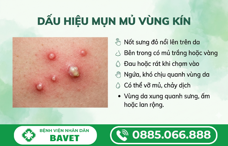 CÁCH CHỮA MỤN MỦ Ở VÙNG KÍN