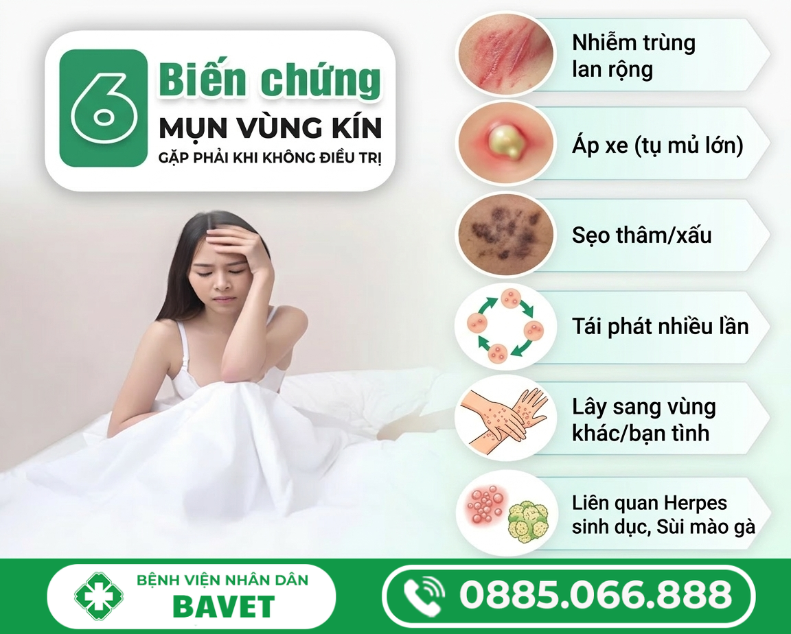 CÁCH CHỮA MỤN THỊT VÙNG KÍN