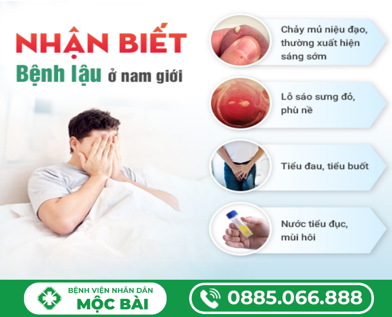 BỆNH LẬU MÃN TÍNH Ở NAM GIỚI