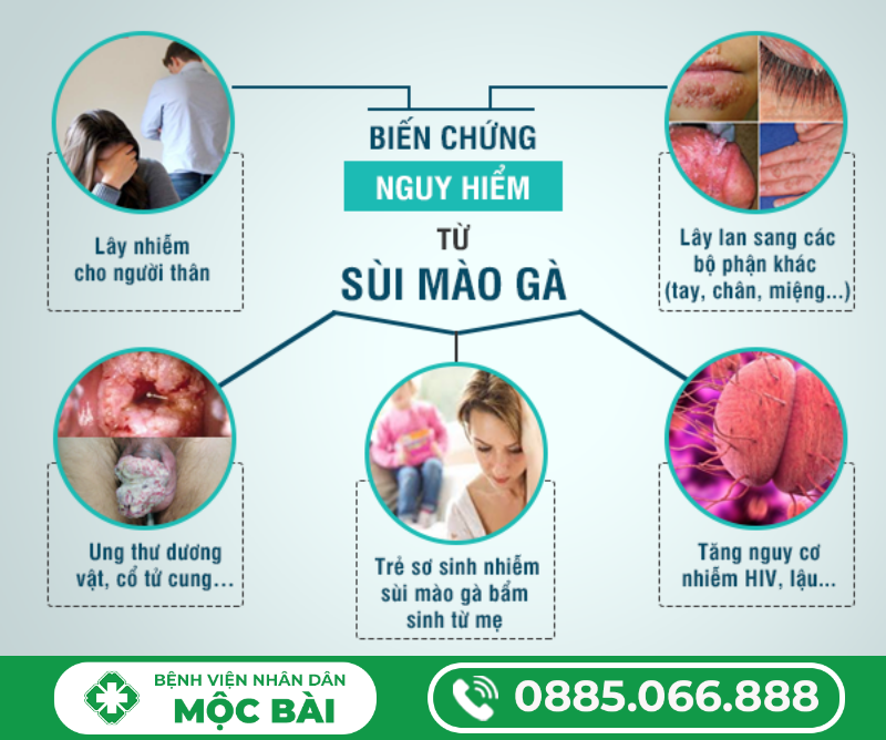 TÁC HẠI CỦA BỆNH SÙI MÀO GÀ