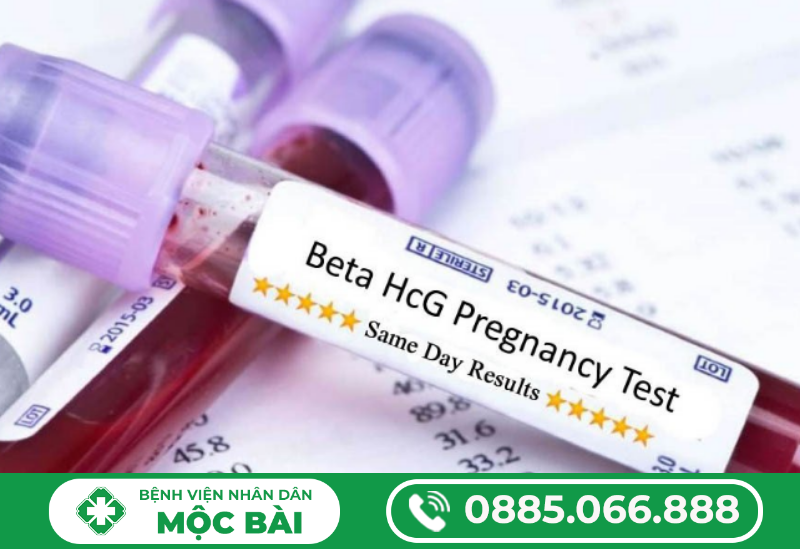 XÉT NGHIỆM BETA (HCG) LÀ GÌ?