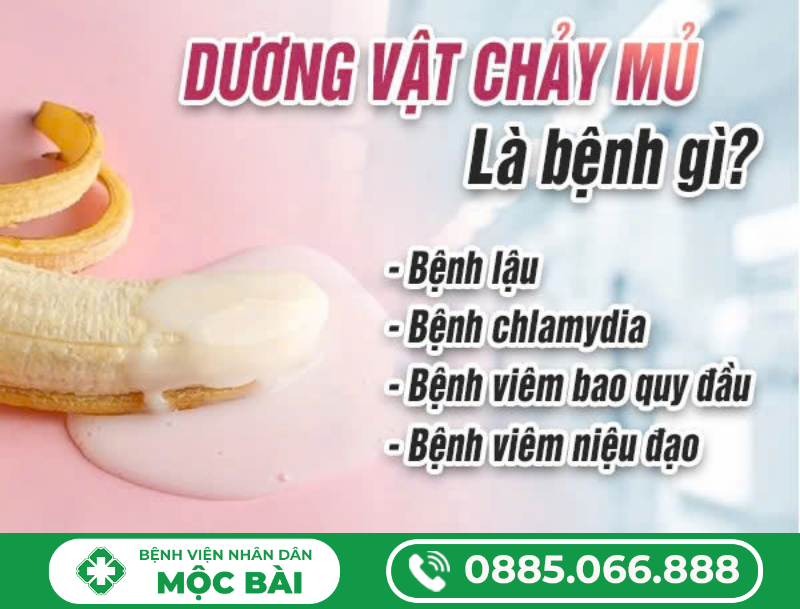 DƯƠNG VẬT CHẢY MỦ LÀ BỆNH GÌ?