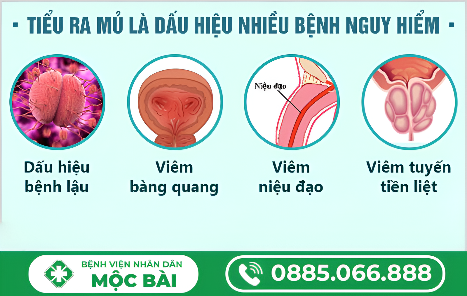 ĐI TIỂU BUỐT RA MỦ LÀ BỆNH GÌ?