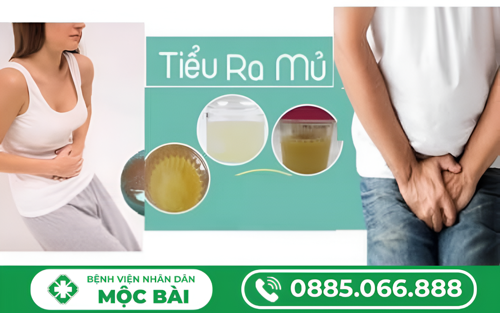 ĐI TIỂU BUỐT CÓ MỦ TRẮNG LÀ BỆNH GÌ?