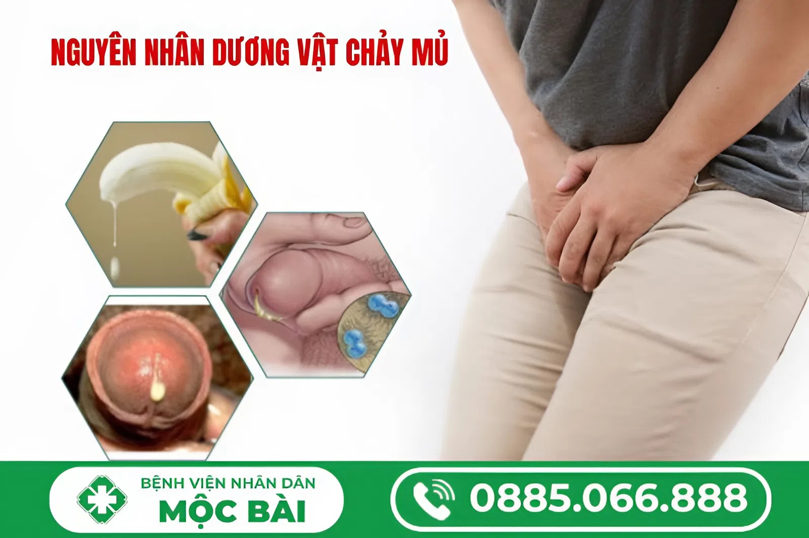 TÌM HIỂU DƯƠNG VẬT CHẢY DỊCH LÀ BỆNH GÌ?