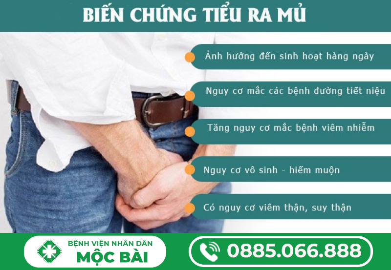 DƯƠNG VẬT TIỂU BUỐT RA MỦ