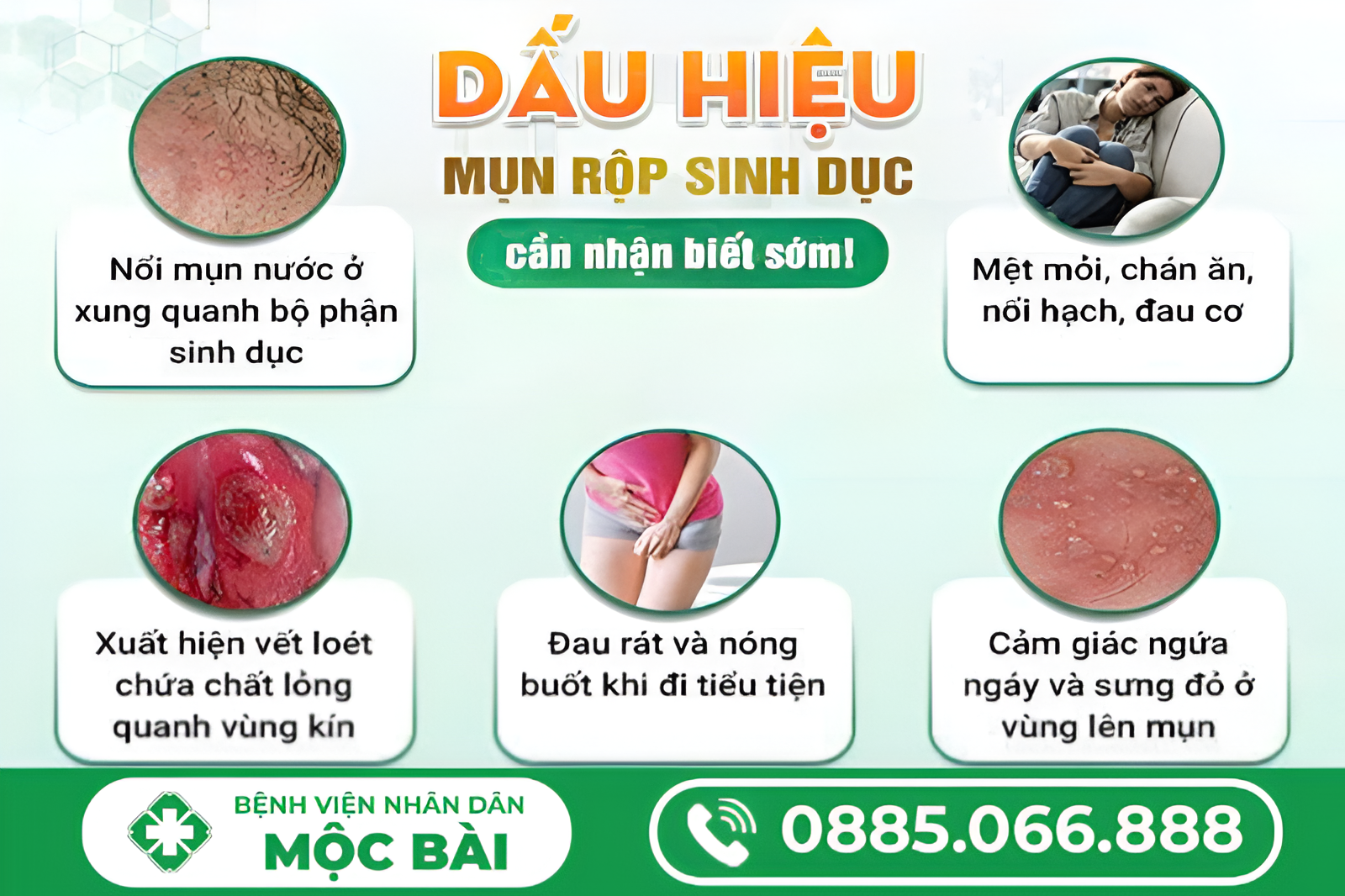 TÌM HIỂU VỀ BỆNH HERPERS
