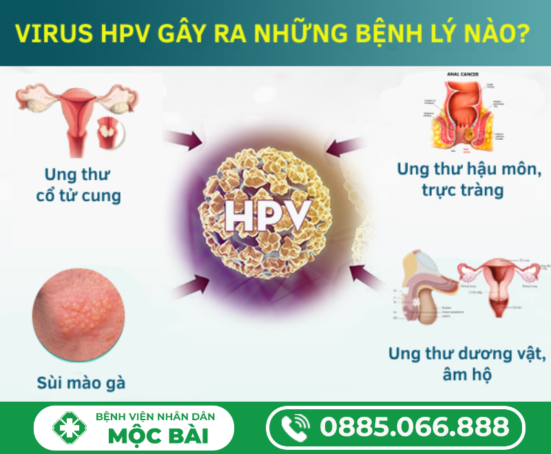 NÊN XÉT NGHIỆM HPV Ở ĐÂU TẠI BAVET