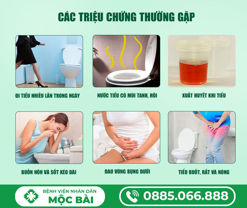 BIỂU HIỆN BỆNH VIÊM BÀNG QUANG