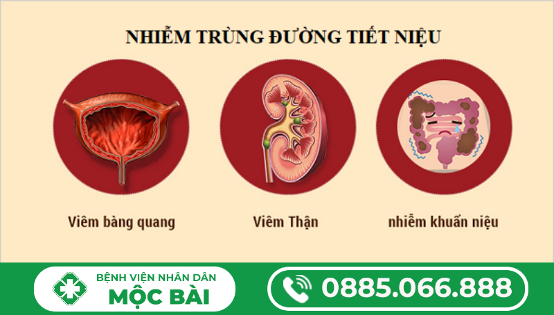 NHIỄM TRÙNG, NHIỄM KHUẨN ĐƯỜNG TIẾT NIỆU