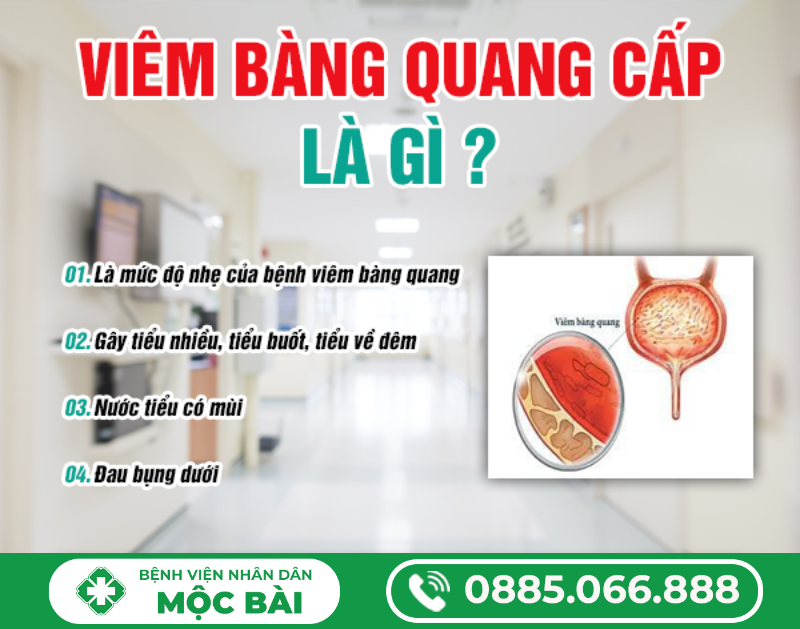 TÌM HIỂU VỀ BỆNH VIÊM BÀNG QUANG CẤP