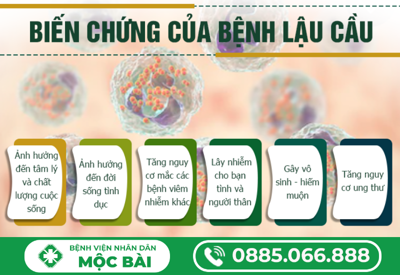 TƯ VẤN VỀ BỆNH LẬU AN TOÀN, MIỄN PHÍ