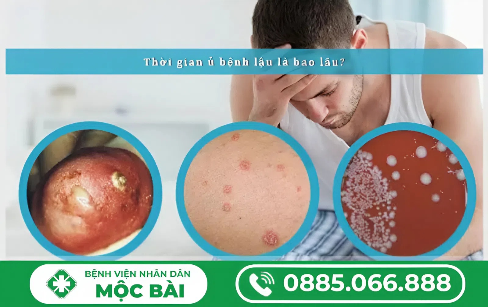 THỜI GIAN Ủ BỆNH CỦA BỆNH LẬU