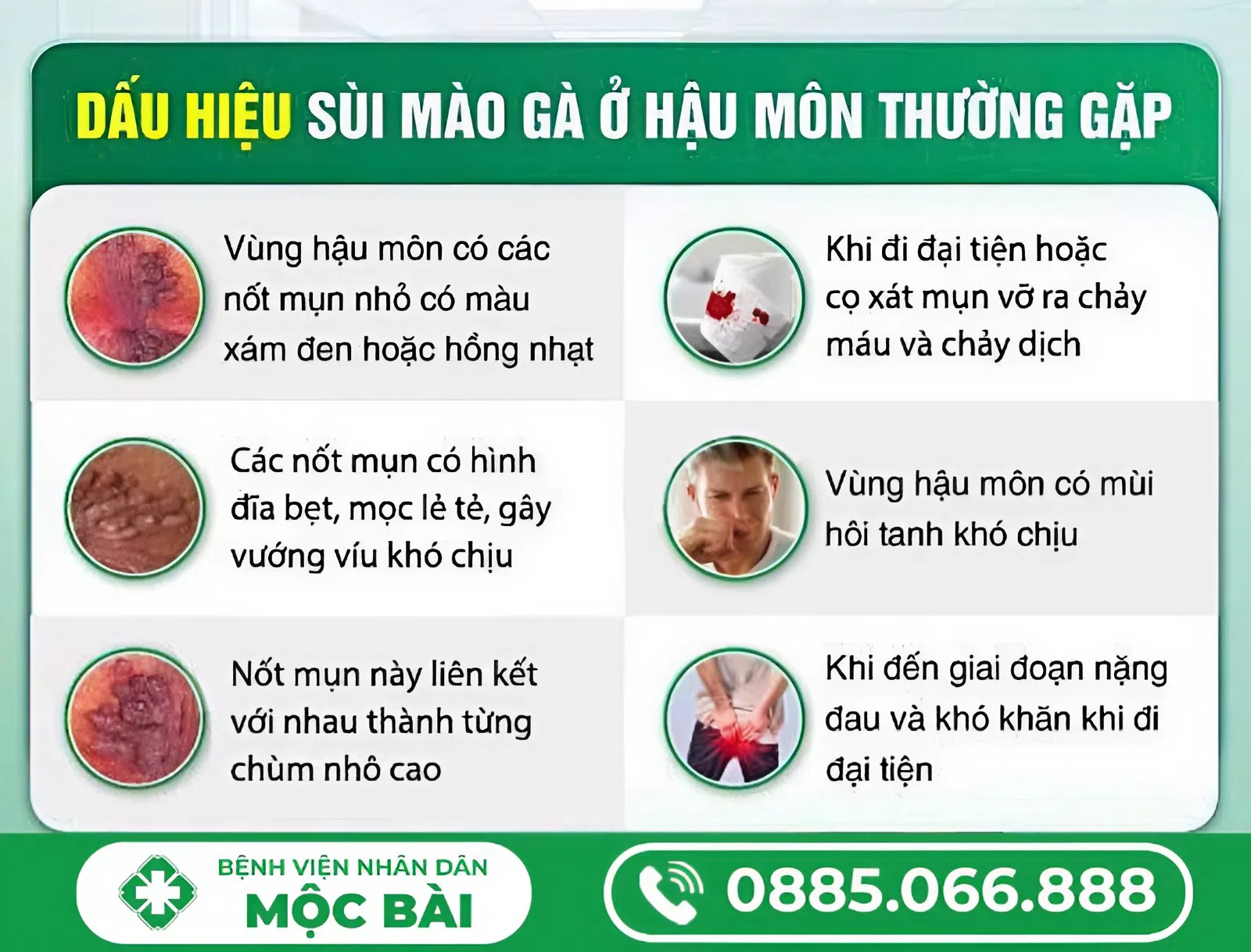 BIỂU HIỆN BỆNH SÙI MÀO GÀ Ở HẬU MÔN