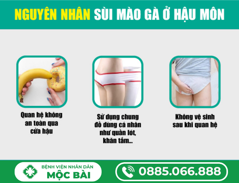 BỆNH SÙI MÀO GÀ HẬU MÔN GIAI ĐOẠN ĐẦU