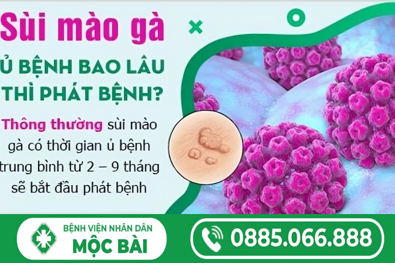THỜI GIAN Ủ BỆNH CỦA SÙI MÀO GÀ LÀ BAO LÂU?