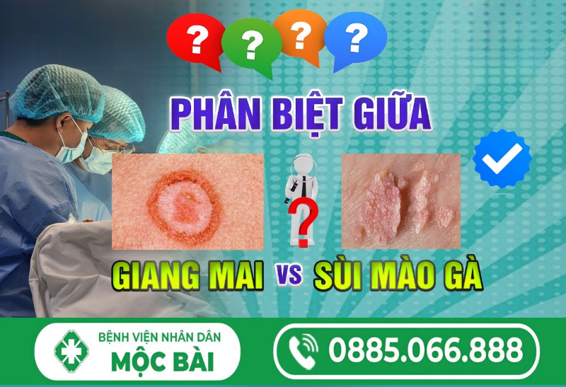 BỆNH GIANG MAI VÀ SÙI MÀO GÀ: BÁC SĨ GIẢI THÍCH CHI TIẾT