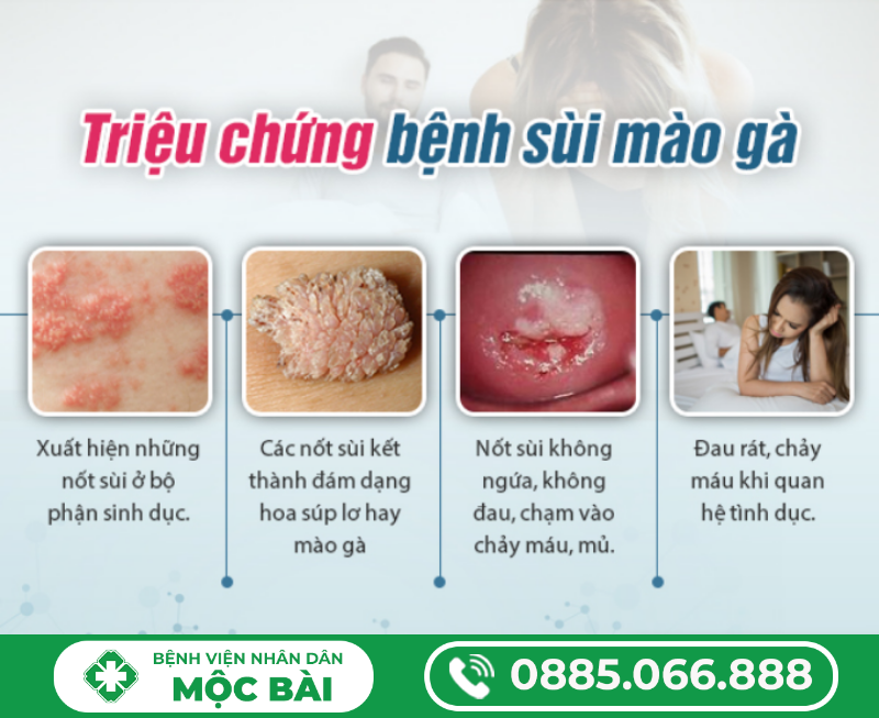PHÂN BIỆT MỤN RỘP SINH DỤC VÀ SÙI MÀO GÀ