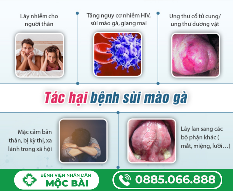 PHÁC ĐỒ ĐIỀU TRỊ SÙI MÀO GÀ – HƯỚNG DẪN CHI TIẾT