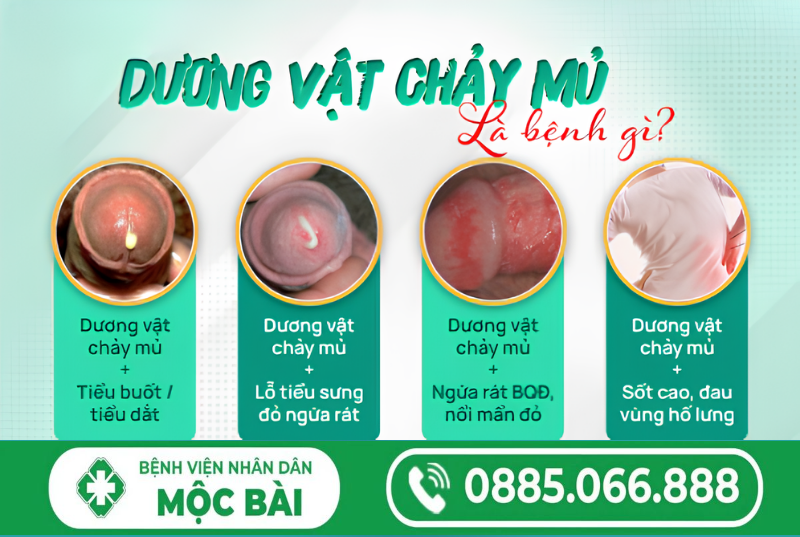 DƯƠNG VẬT CHẢY MỦ VÀNG