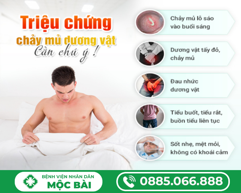DƯƠNG VẬT CHẢY MỦ TRẮNG