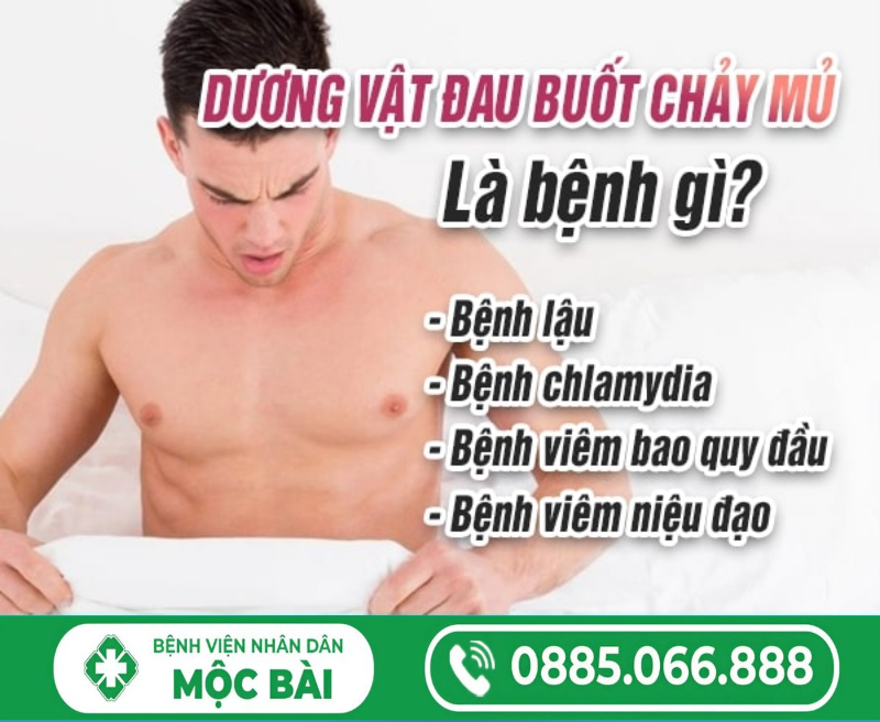 DƯƠNG VẬT ĐAU BUỐT CHẢY MỦ