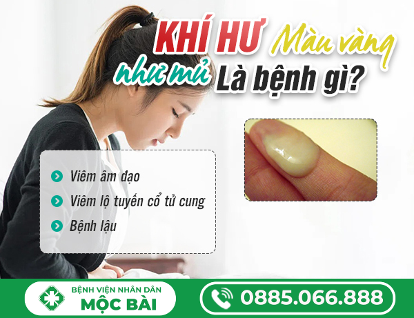 KHÍ HƯ MÀU VÀNG NHƯ MỦ