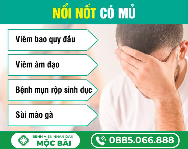 NỔI NỐT CÓ MỦ – DẤU HIỆU CẢNH BÁO VIÊM NHIỄM HOẶC BỆNH LÝ DA LIỄU