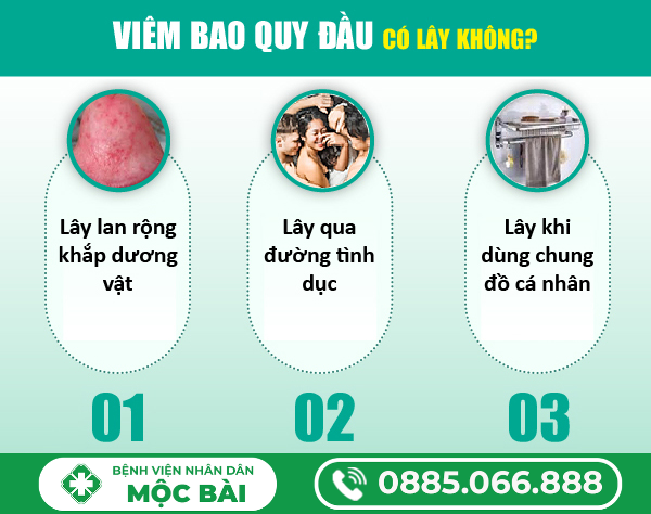 BỆNH VIÊM BAO QUY ĐẦU CÓ LÂY KHÔNG?