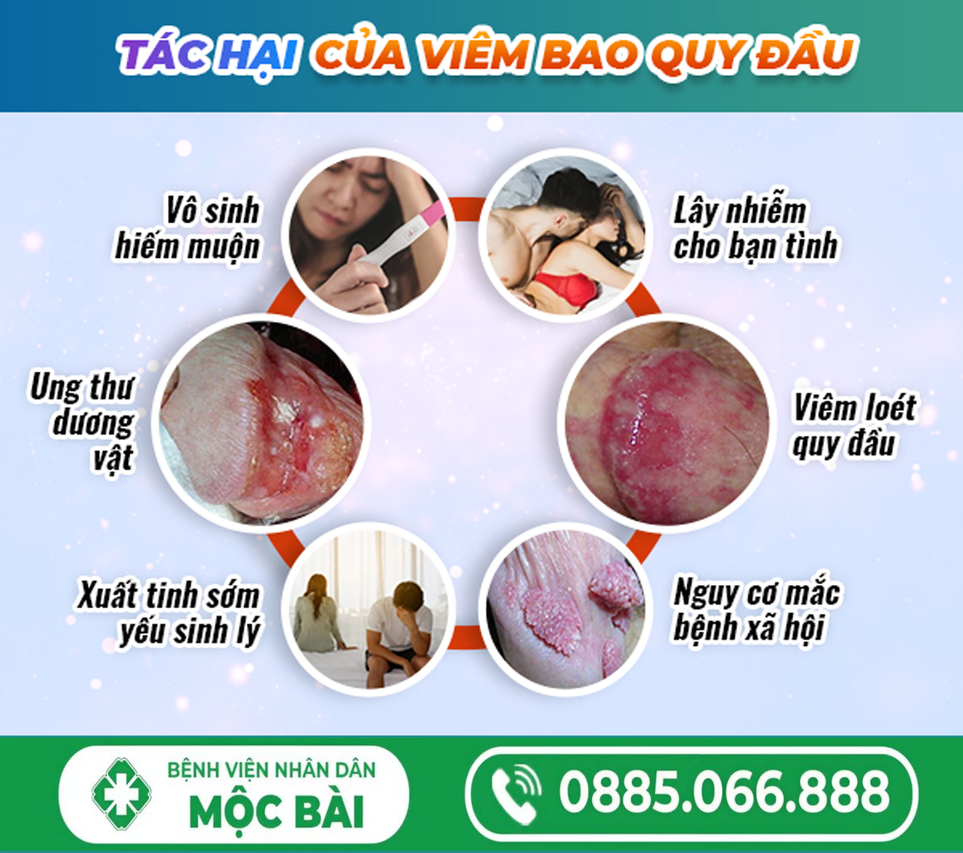 TÌM HIỂU BỆNH VIÊM BAO QUY ĐẦU