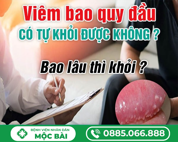 VIÊM BAO QUY ĐẦU CÓ TỰ KHỎI ĐƯỢC KHÔNG? BAO LÂU THI KHỎI?