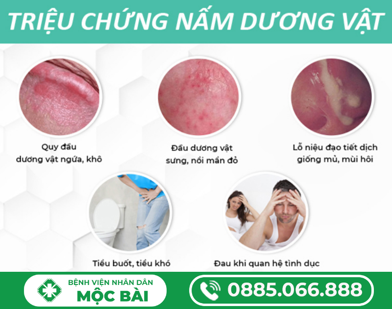 HÌNH ẢNH NHẬN BIẾT BỆNH NẤM BAO QUY ĐẦU